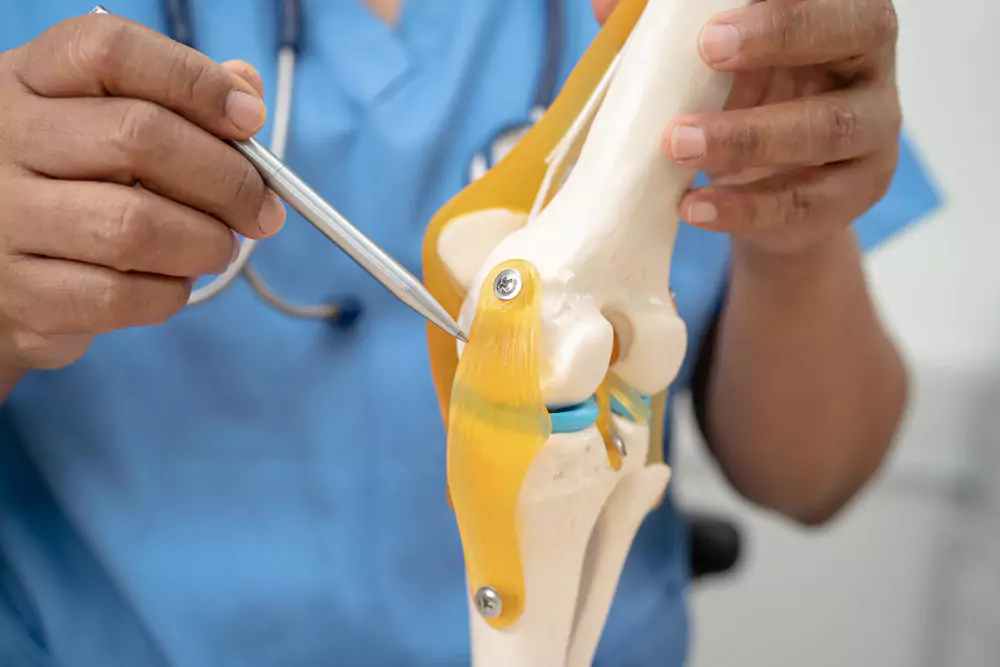 Knee Arthroscopy