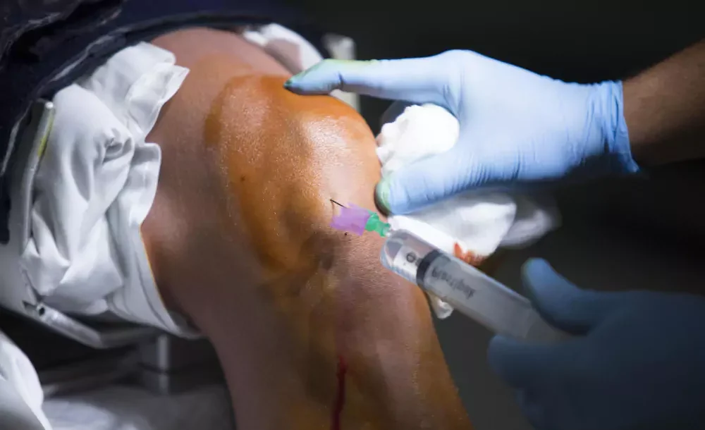 ACL Repair & Reconstruction